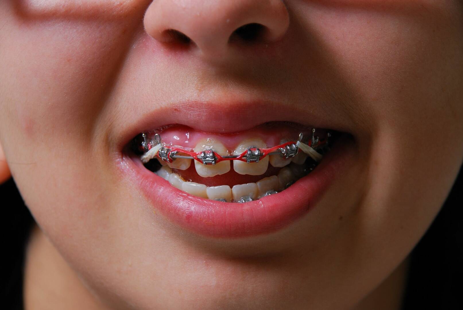 Glenmore Dental